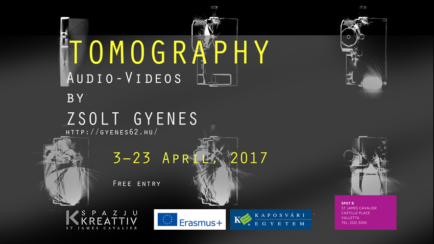 gyenes tomography